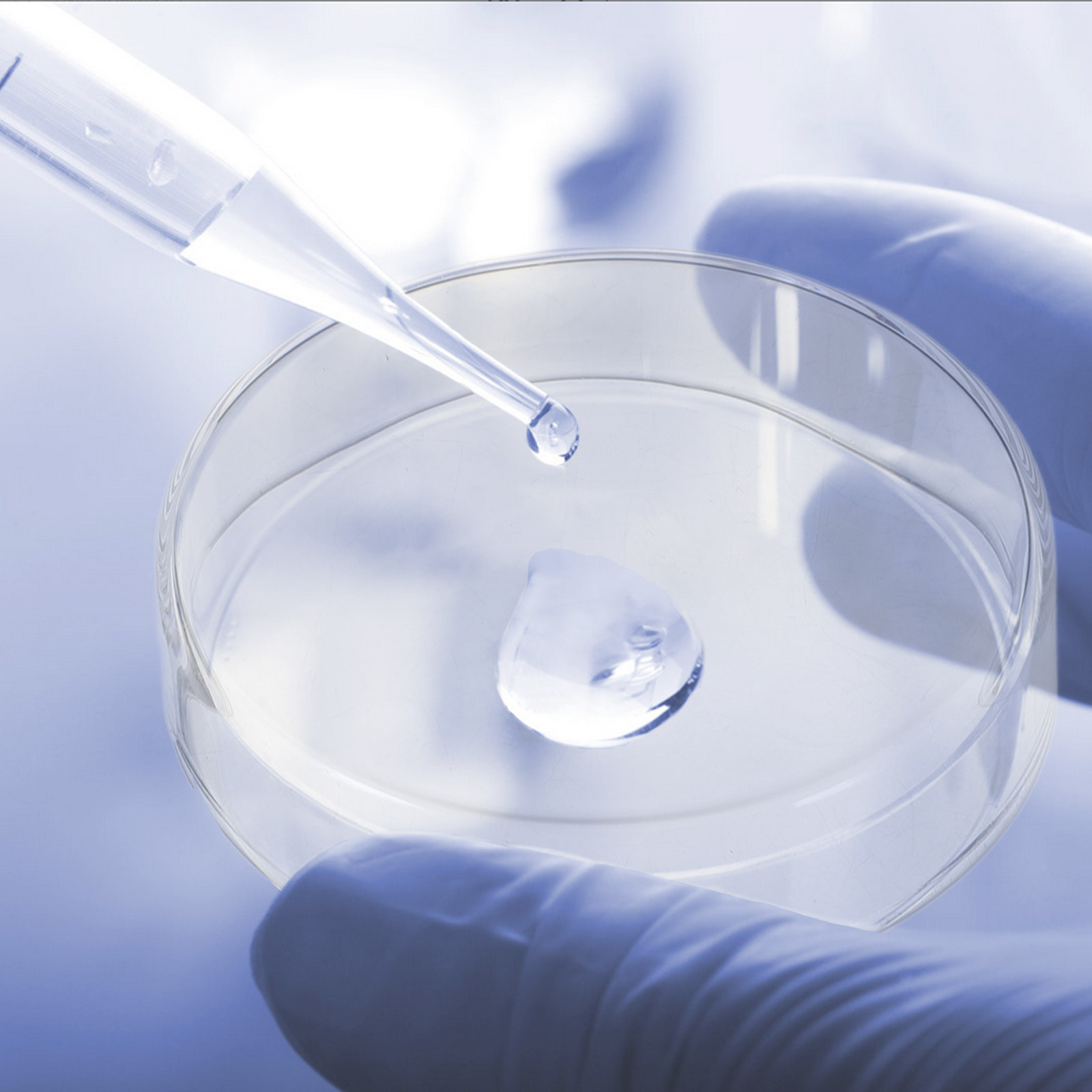 1Set Cawan Petri Kaca Tebal ya - Agar Tissue Culture ulasan dan harga